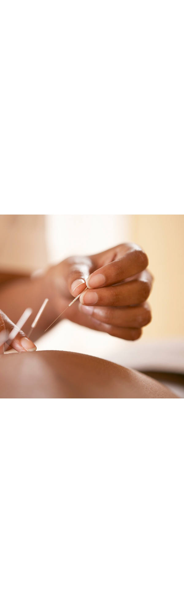 Akupunktur Wirkung: Energie zum Fliessen bringen