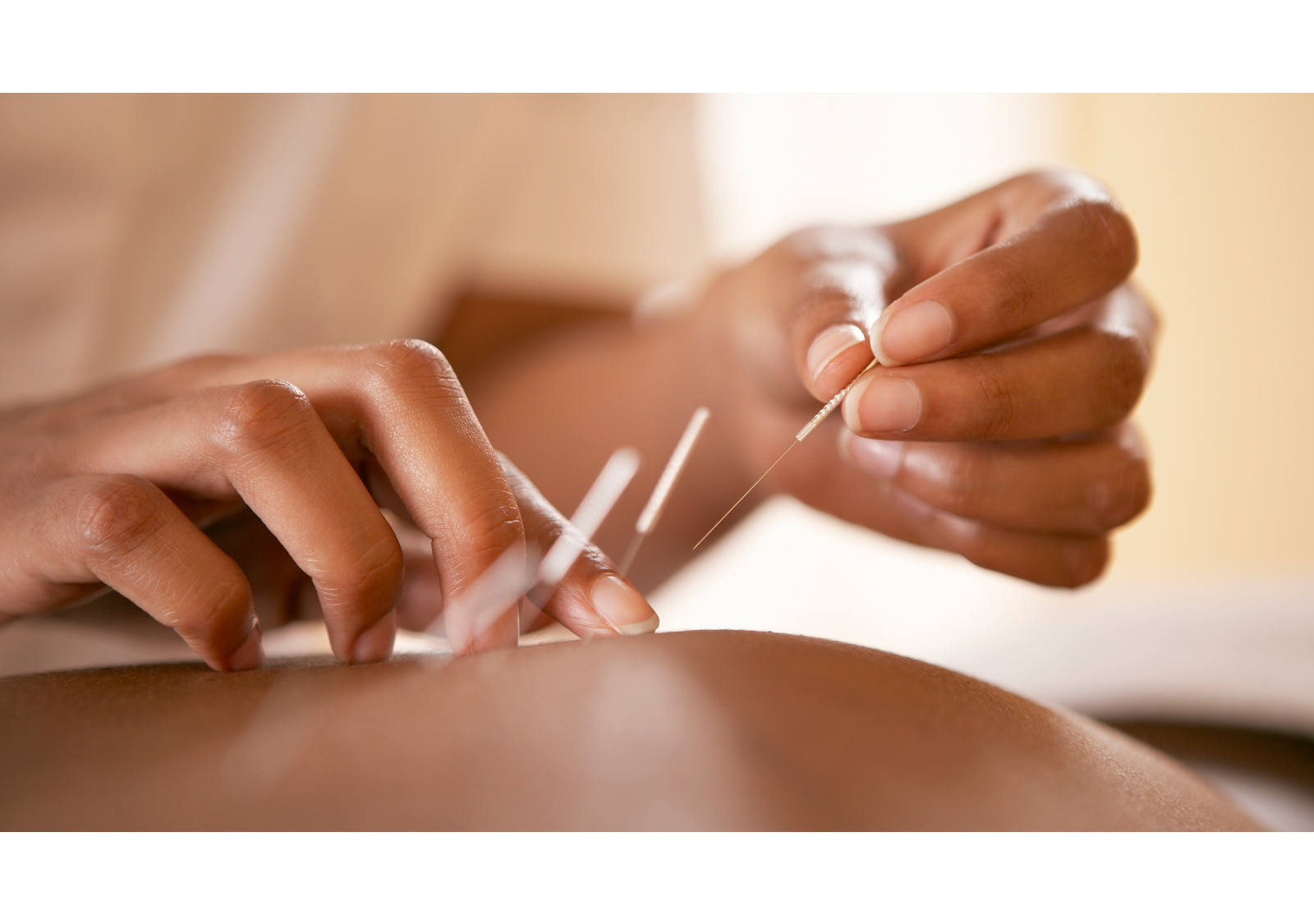 Akupunktur Wirkung: Energie zum Fliessen bringen