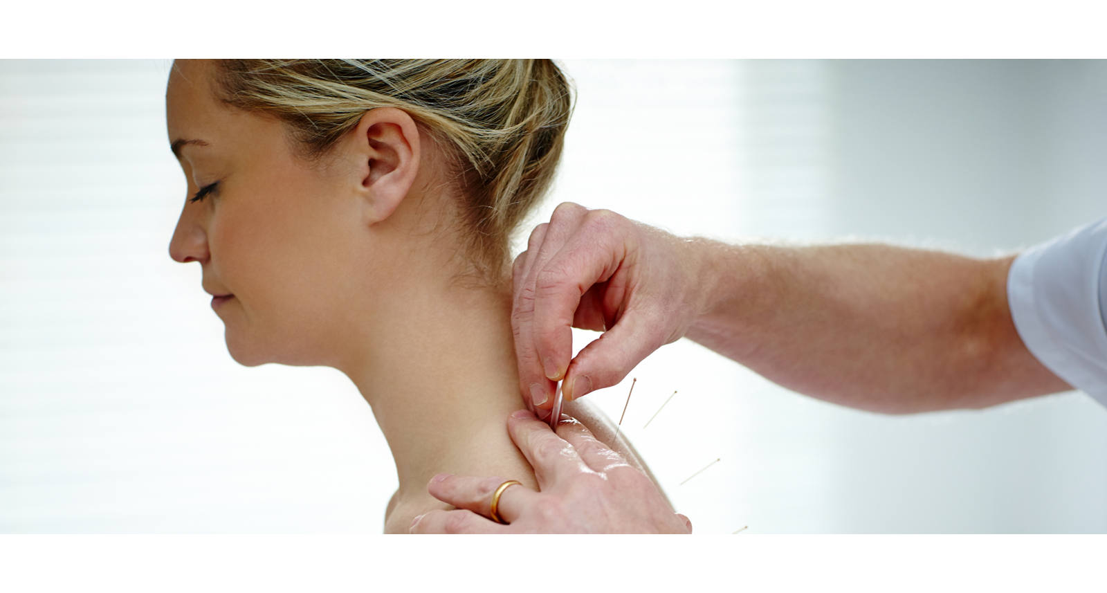 Dry Needling gegen Muskelverhärtungen
