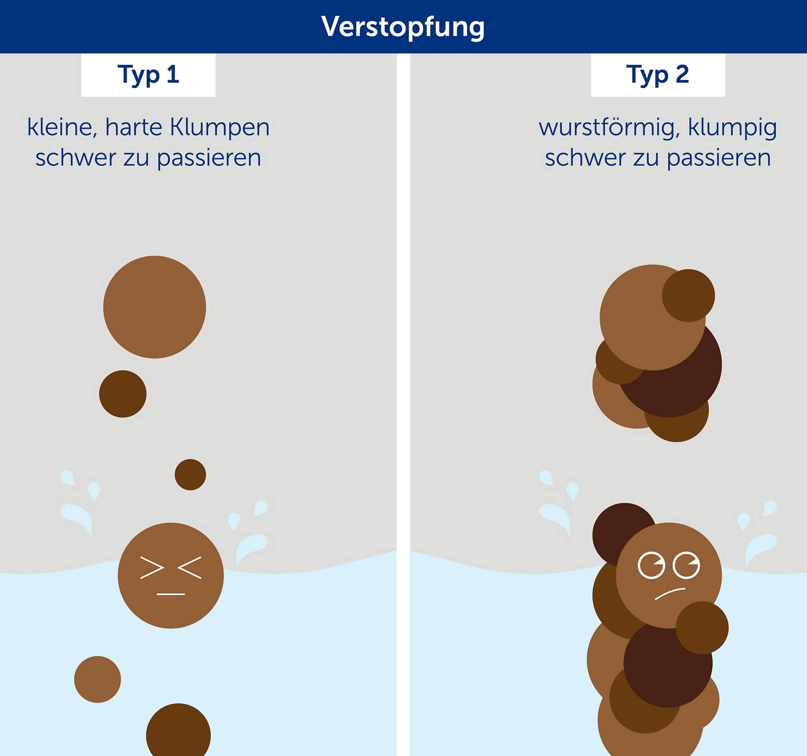 Typ 1-2 von Stuhlgang: Illustration von Verstopfung