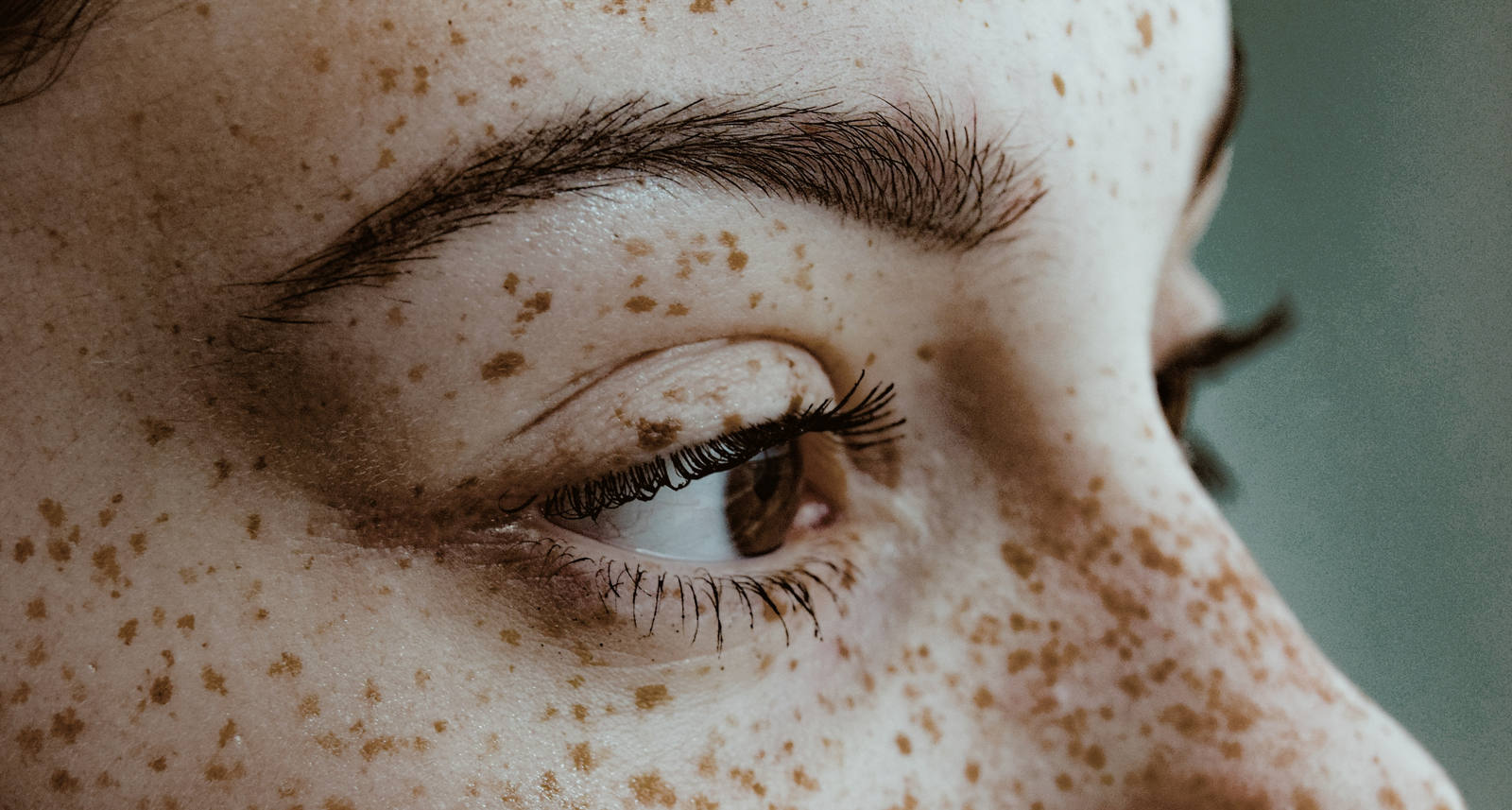 Primo piano di una donna con molte lentiggini sul viso